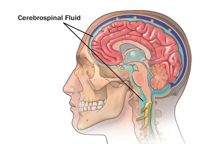 Can Cerebrospinal Fluid Leak From Eyes Full Release